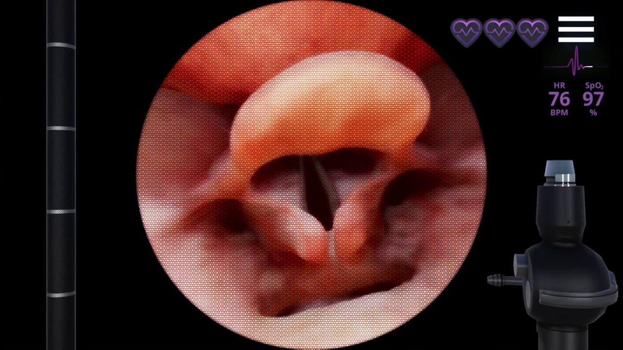 AirwayEx trailer thumbnail