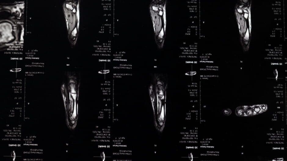 Nihilist Syndrome banner