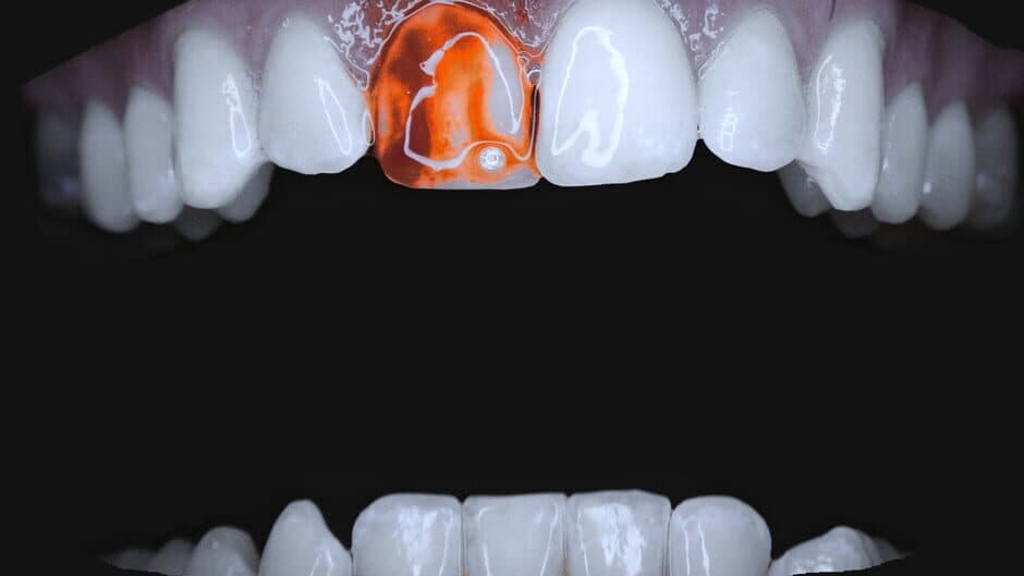 Teeth Cutter banner